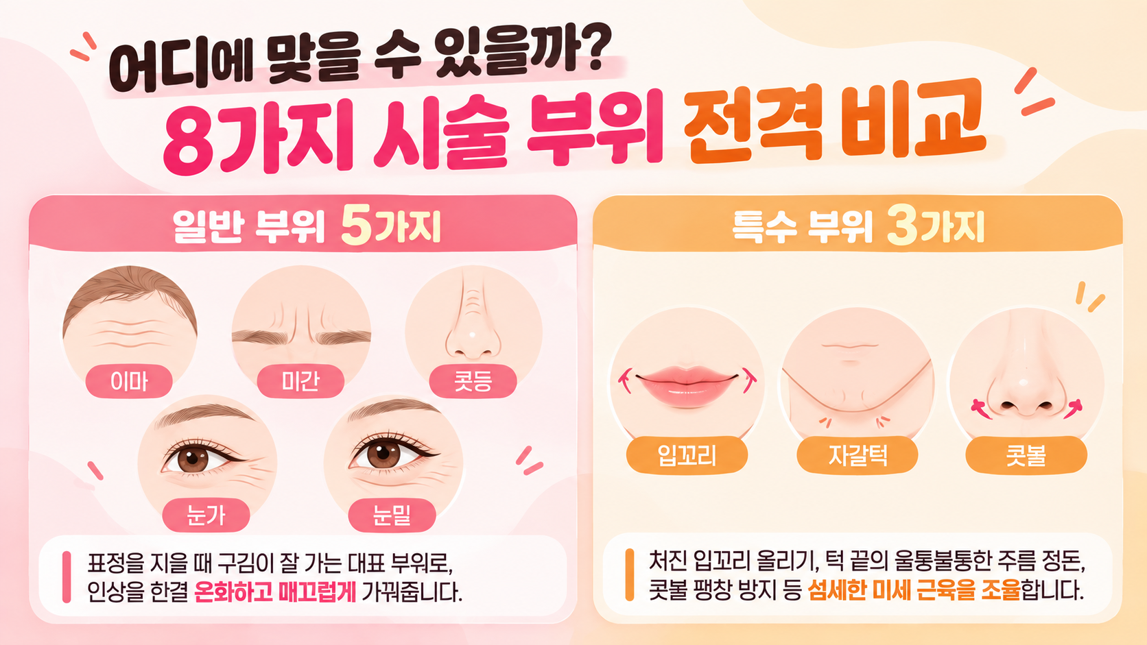 주름보톡스 시술 부위 가이드(AI이미지활용)