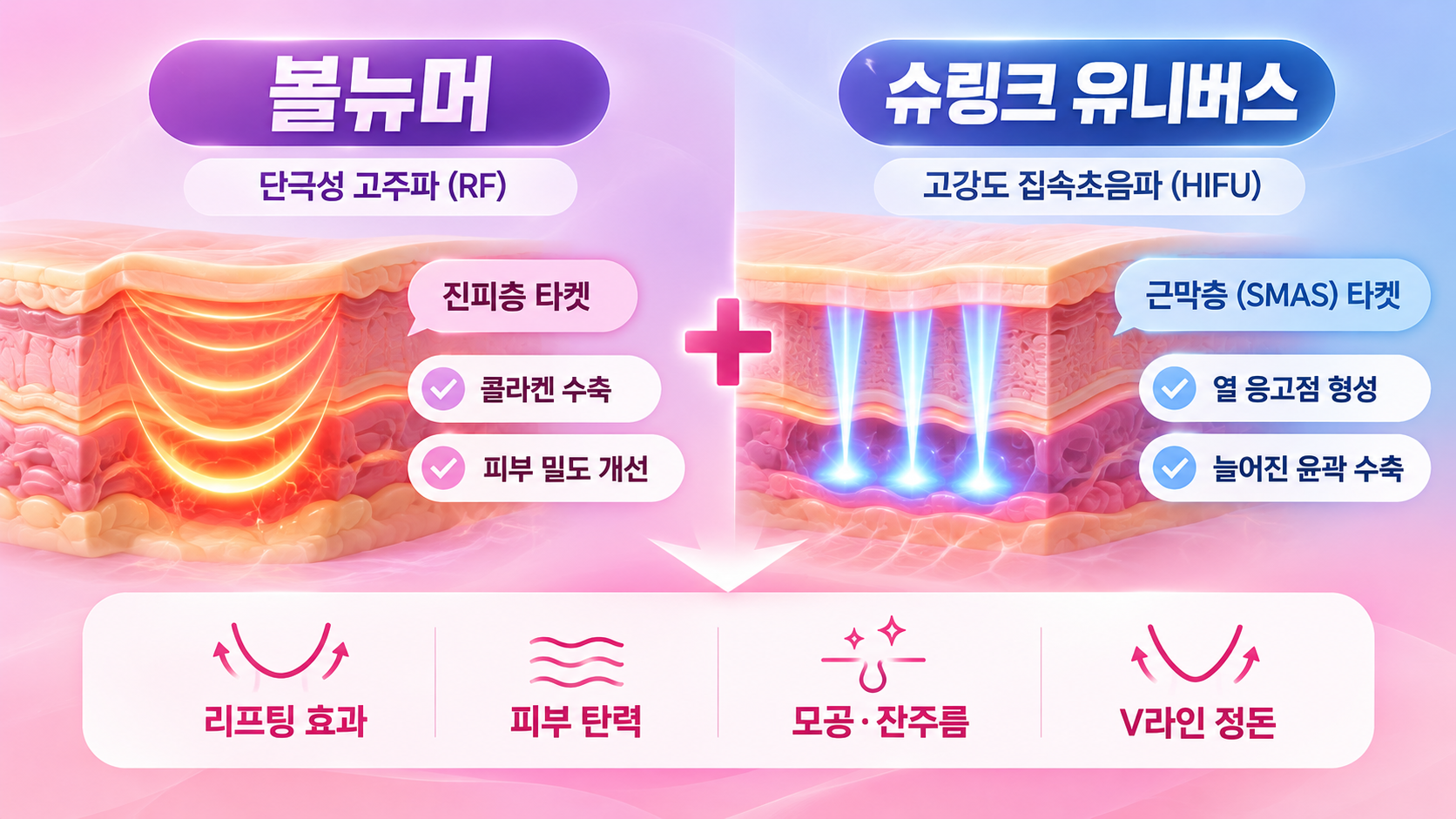 볼링크 시술 원리 및 피부 도달층 비교(AI이미지활용)