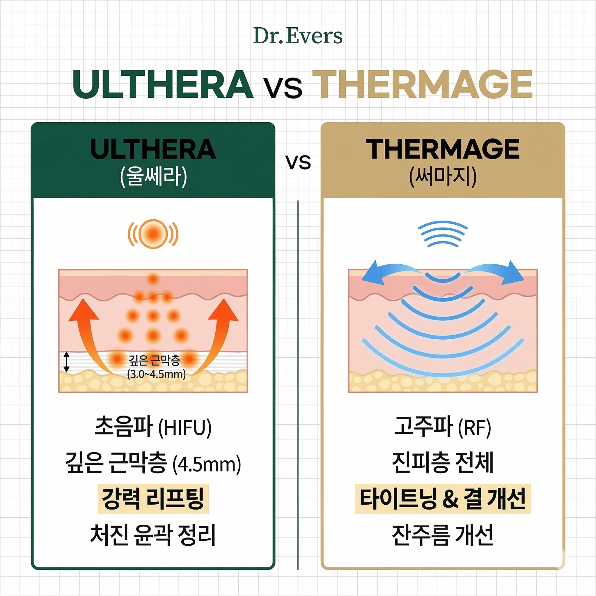 울쎄라 써마지 비교