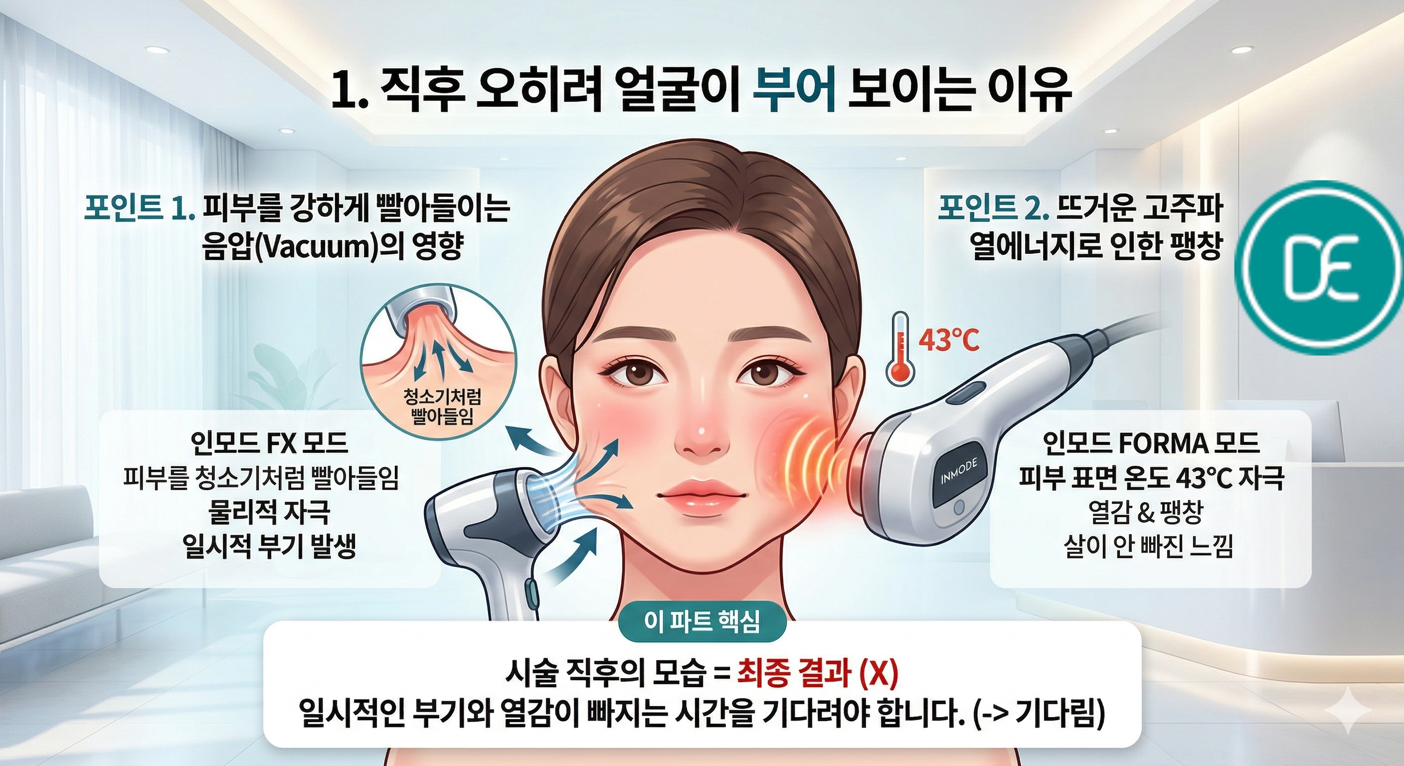 인모드,인모드FX,인모드FORMA,인모드부작용,인모드붓기