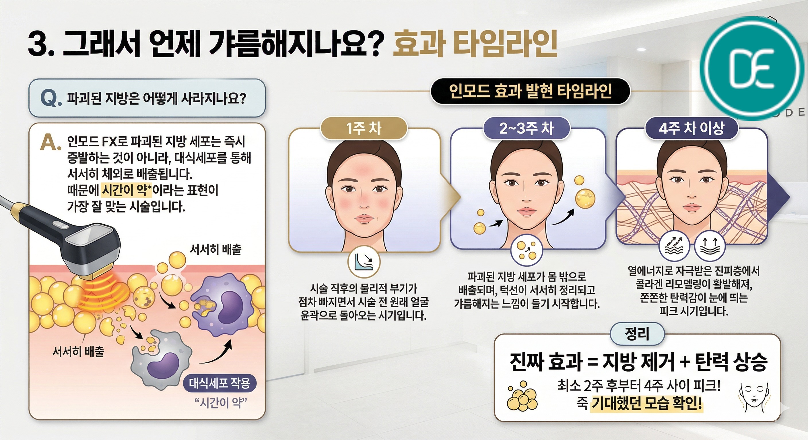 인모드,인모드효과시기,인모드후기,인모드지방파괴,인모드타임라인