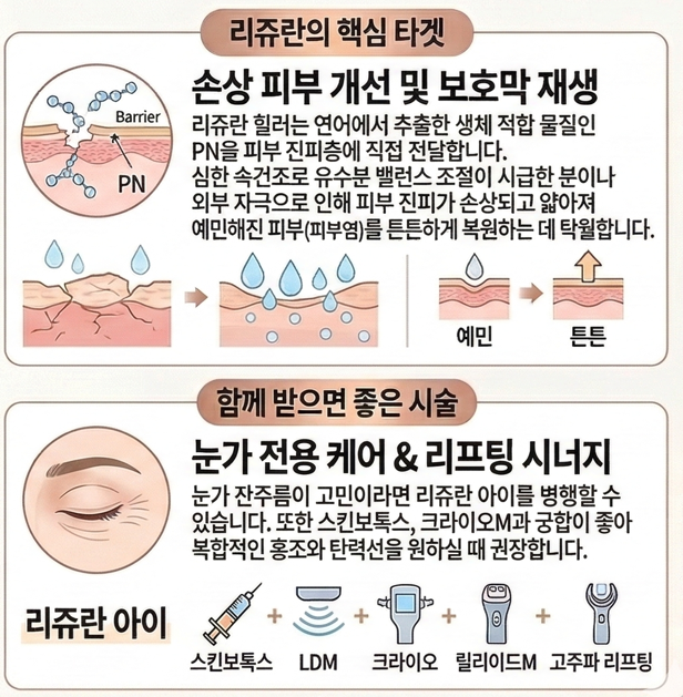 리쥬란 힐러 효과 속건조
