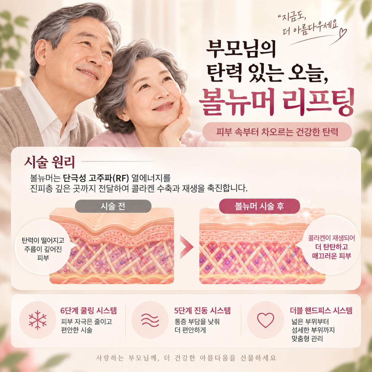 천안 볼뉴머 리프팅 모노폴라 RF 고주파 원리(AI이미지활용)